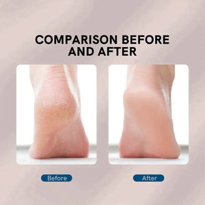 SUPER FEET PERFECT - Lima recargable para el pulido de talones, herramientas de pedicura.