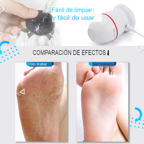 COMFORT FEET - Equipo especial para limpieza de pies.